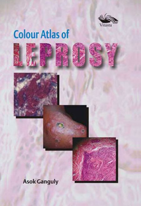 COLOUR ATLAS OF LEPROSY